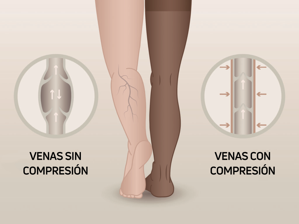 🧦 Alivio para Varices y Piernas Cansadas