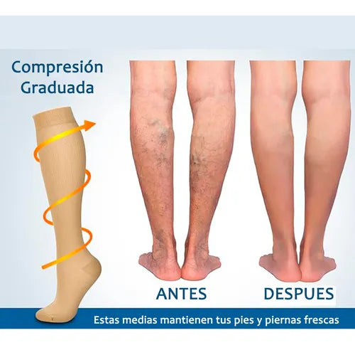 🧦 Alivio para Varices y Piernas Cansadas